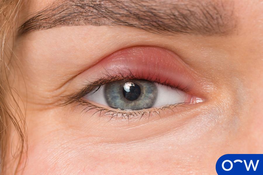 Skincare⁤ Routines to Soothe and⁤ Protect Your ⁢Eyes