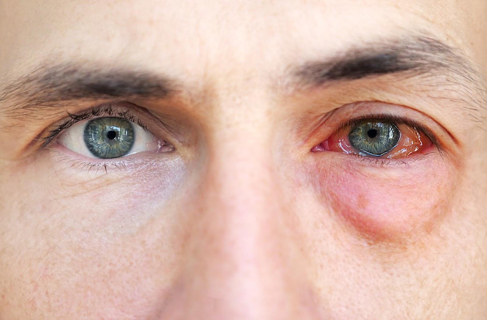 Tips ⁣for Applying Makeup ⁢without Irritating Your eyes